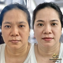 Kỹ thuật viên phun xăm
